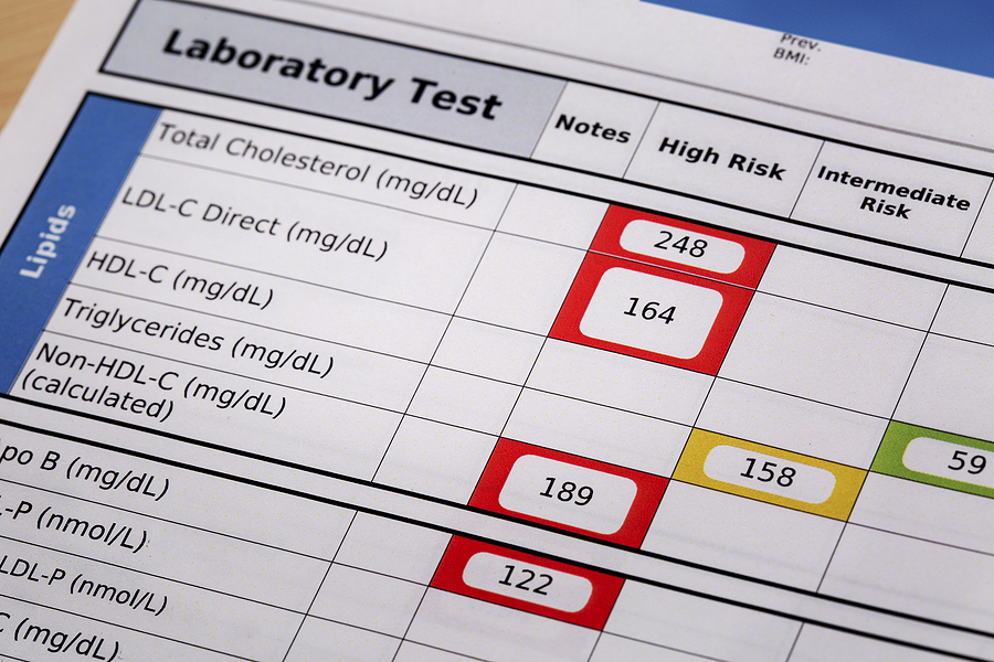 cholesterol-test